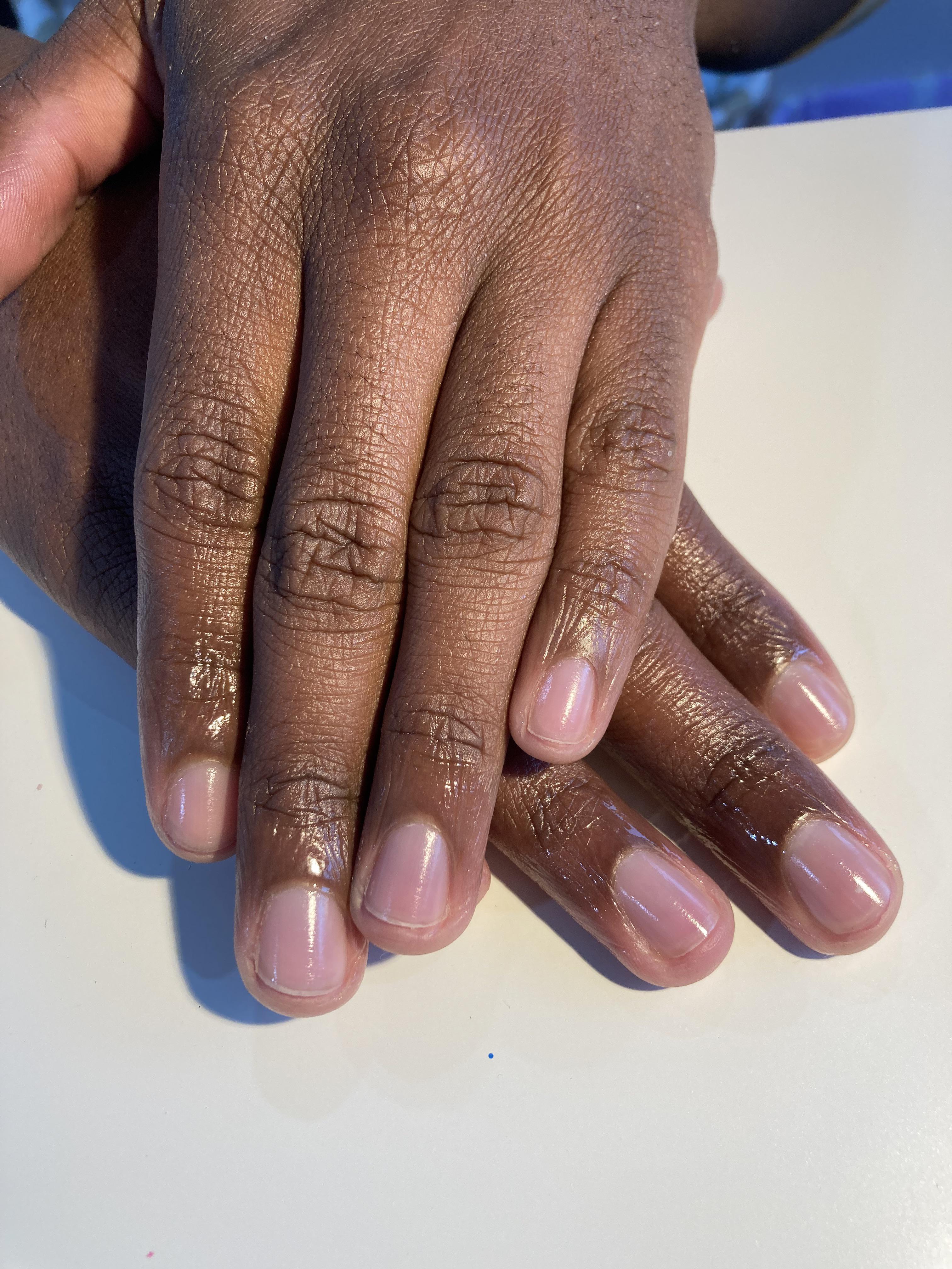 Gel Overlay with Rubber Base